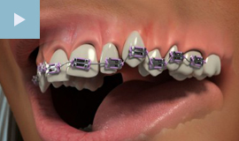 Orthodontics