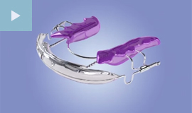 inman aligners